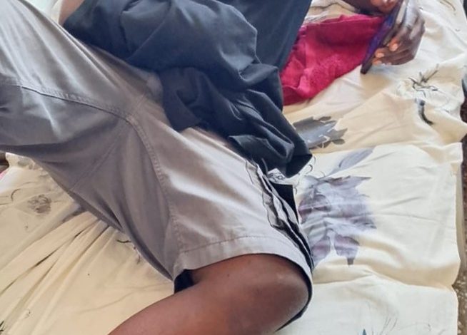 One of the victims who lost his hand.